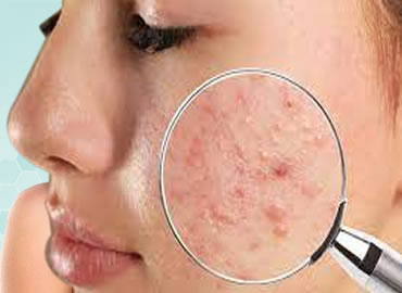 Skin_Treatment